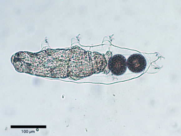 , Tardigrades Walking, #Bizwhiznetwork.com Innovation &Lambda;Ｉ